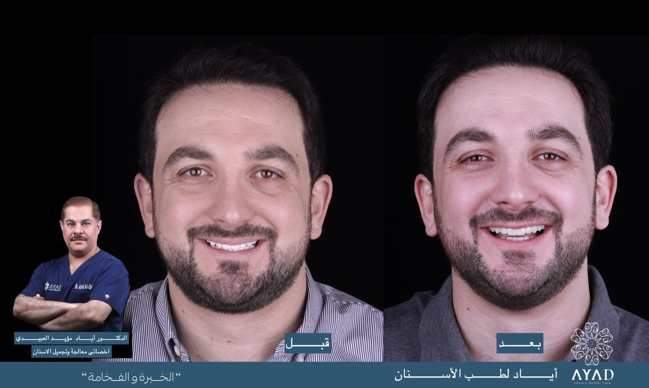 Case card — the same patient photographed before and after, side by side