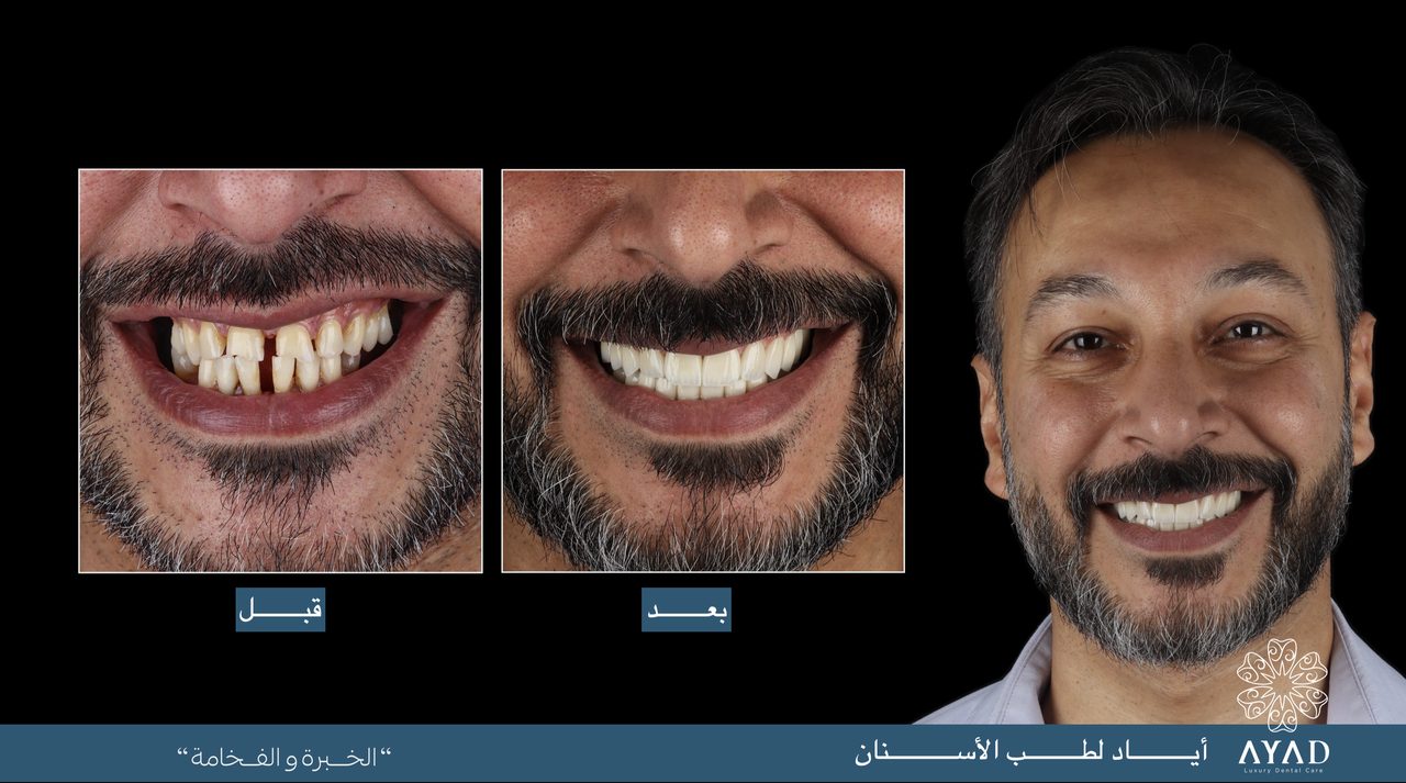 Case card — a patient's smile before and after, beside his finished portrait