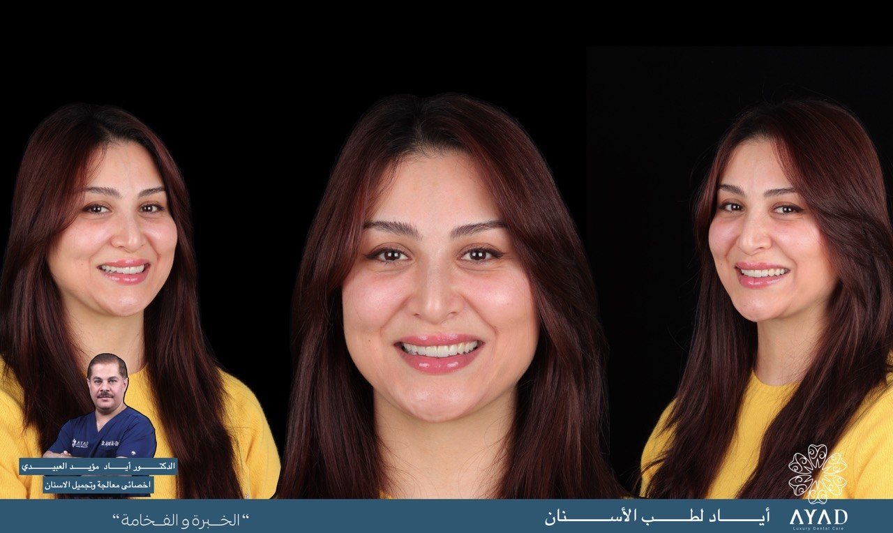 Case card — three portraits of the same patient, before and after