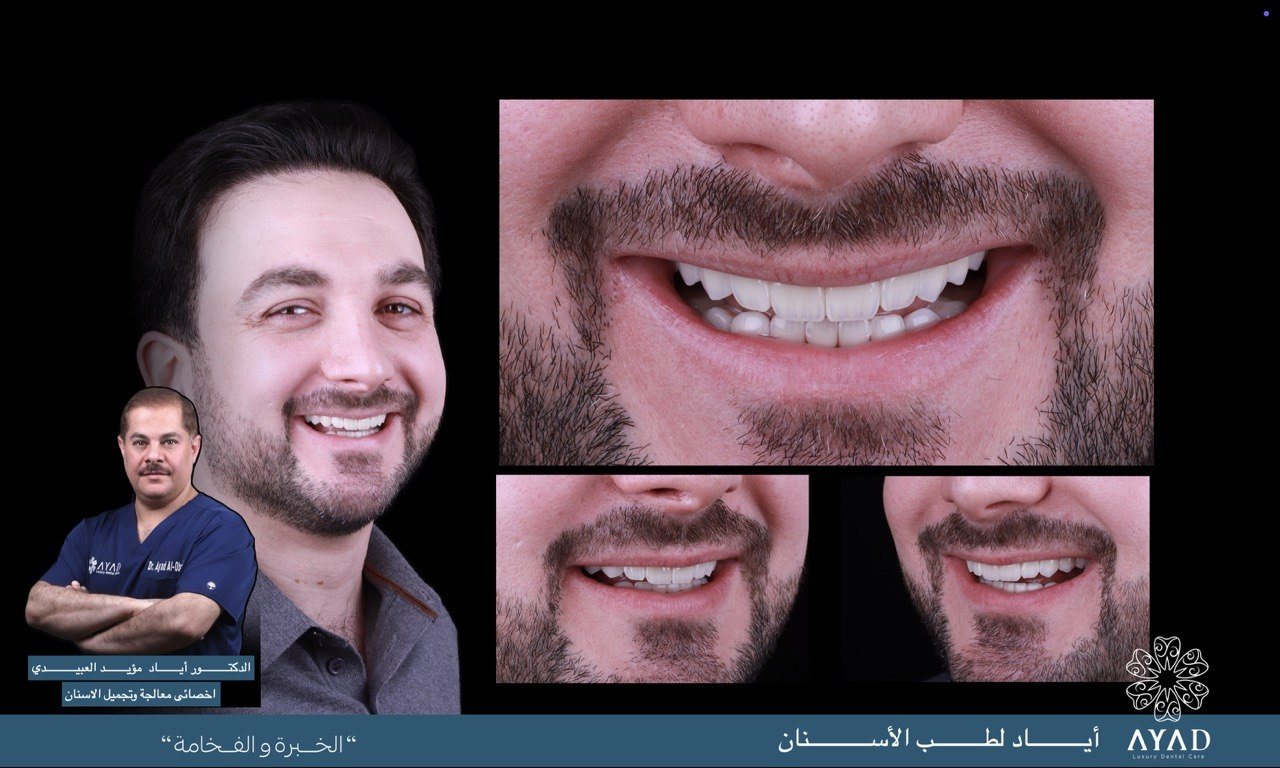 Case card — a patient's smile before and after, with close studies