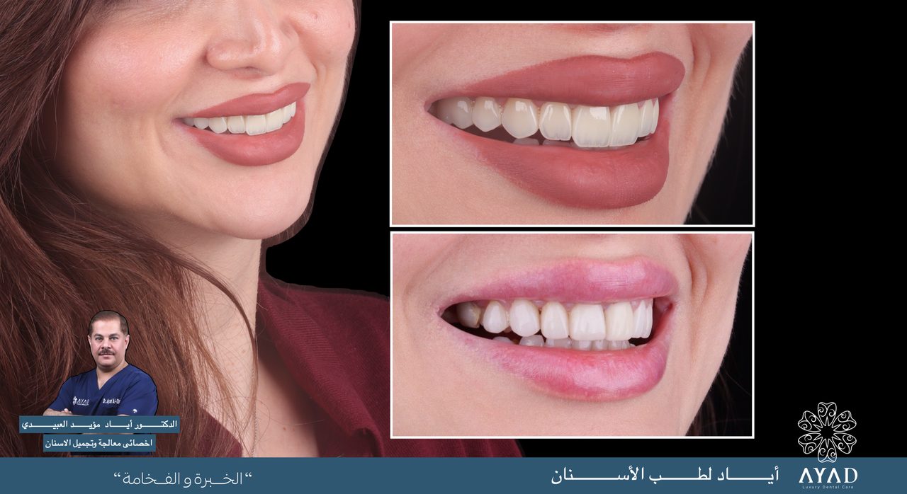 Case card — a patient's portrait beside two close studies of her smile, before and after
