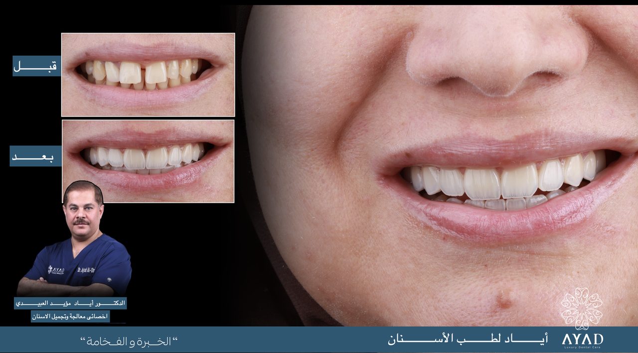 Case card — a wide smile after treatment, beside the before and after studies