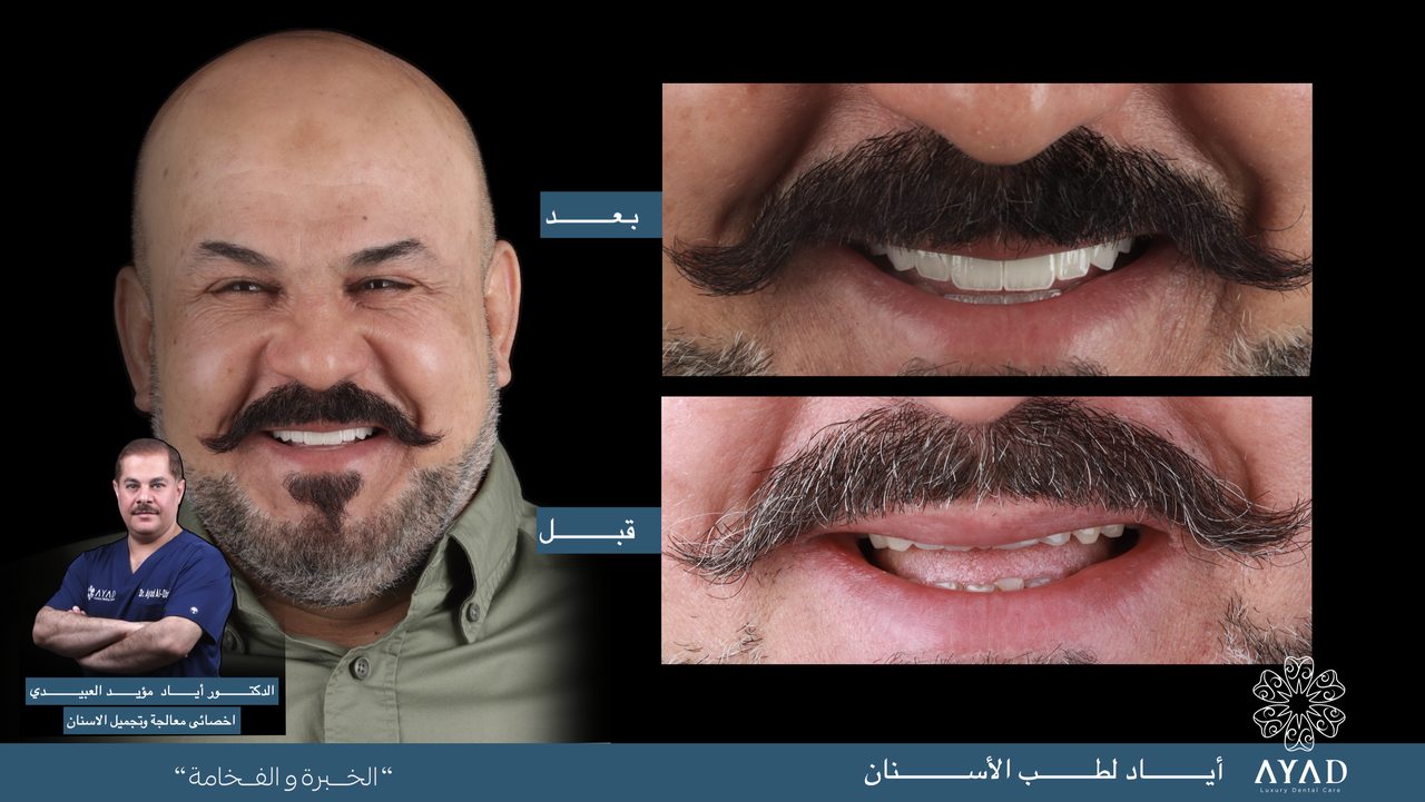 Case card — a patient's portrait beside two close studies of his smile, before and after