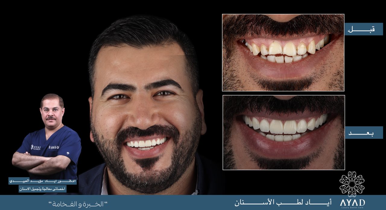 Case card — a patient's portrait beside before and after studies of his smile