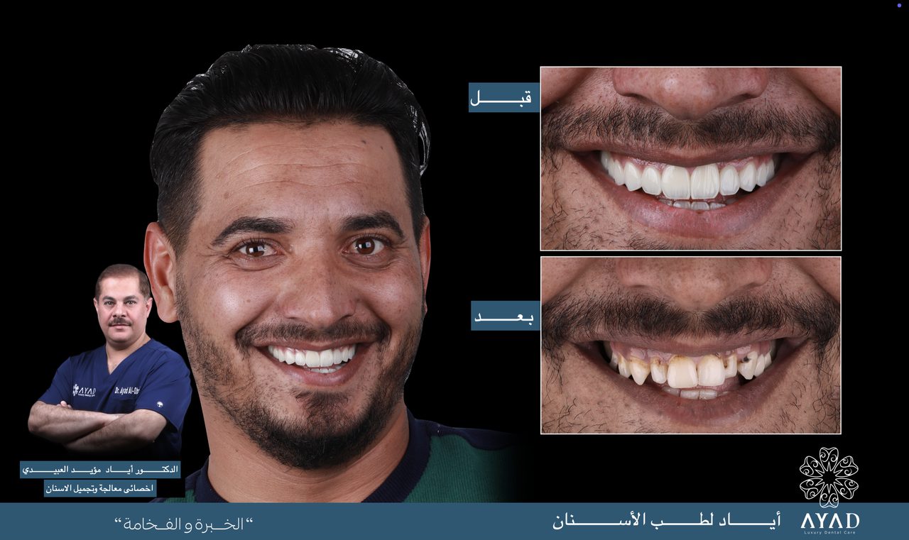 Case card — a patient's portrait beside before and after studies of his smile