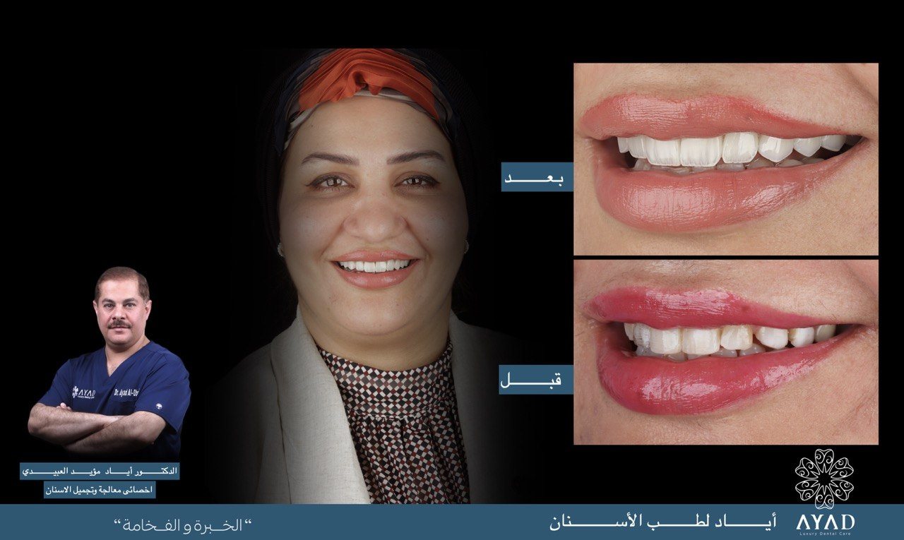 Case card — the same smile labelled before and after