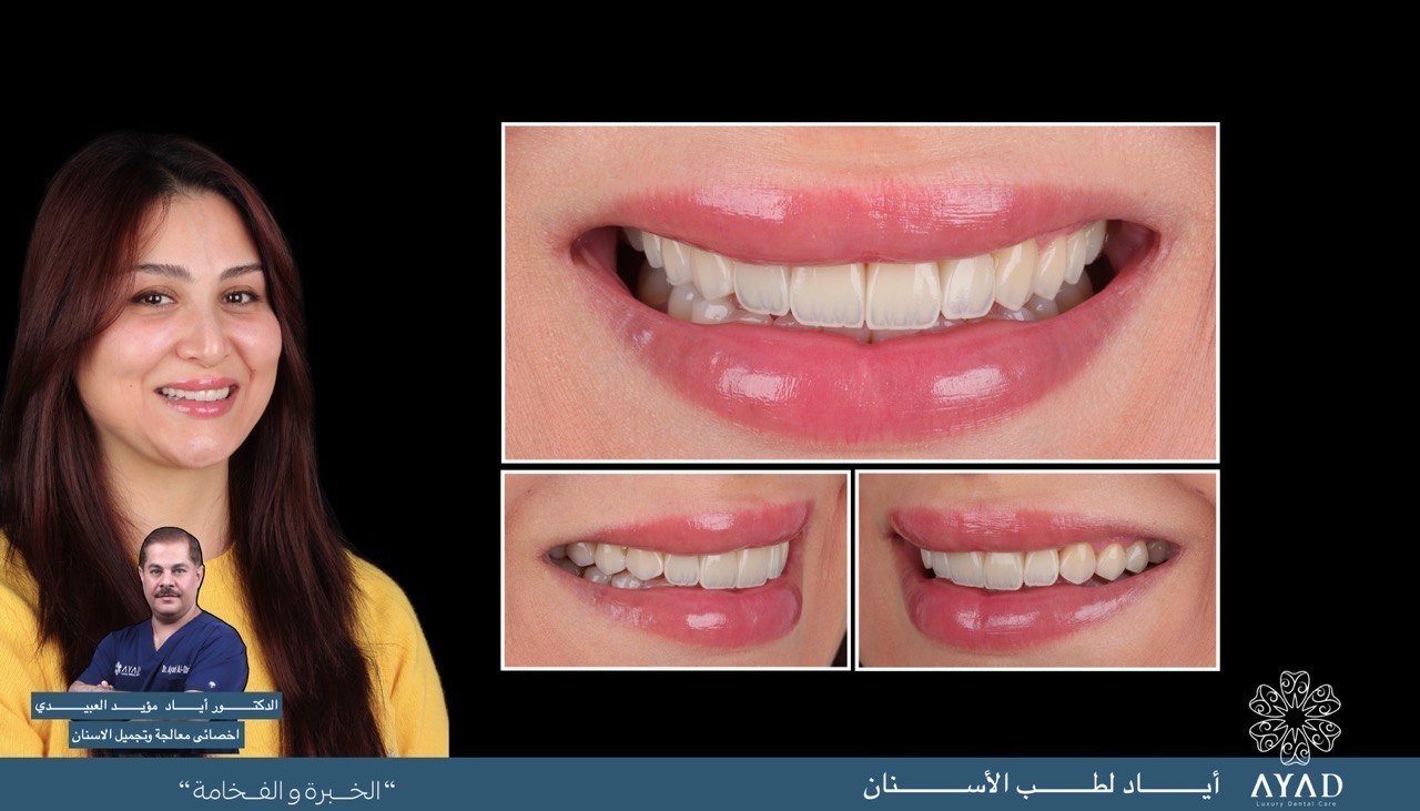 Case card — a patient's smile with before and after close studies